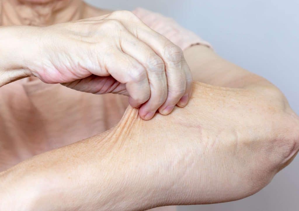 How to Tighten Skin After Weight Loss Naturally 7 An older woman raises her arm, displaying it with a proud expression on her face.
