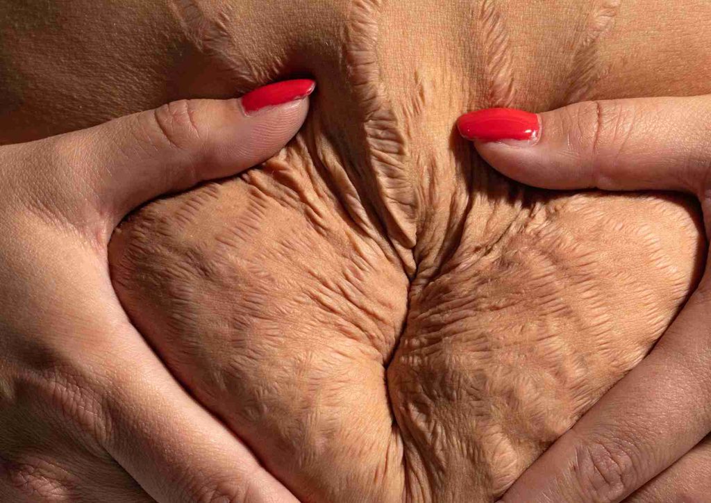 How to Tighten Skin After Weight Loss Naturally 11 A woman's hands gently rest on her belly, highlighting a moment of connection and care.