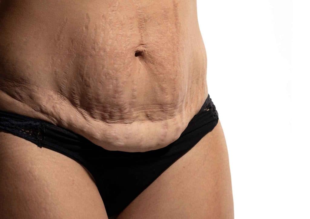 How to Tighten Skin After Weight Loss Naturally 13 A woman with a slim figure, showcasing a flat stomach, standing confidently in a casual outfit.