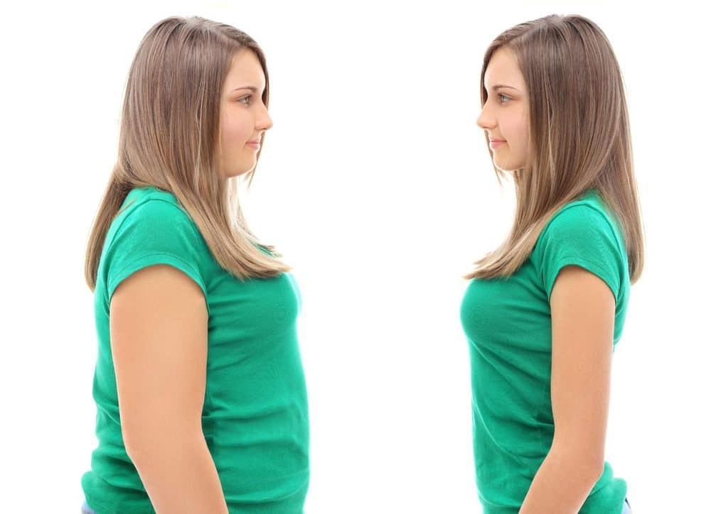 The Best Foods for Weight Loss 15 Before and after photo of a young woman showcasing significant weight loss and transformation in her appearance.