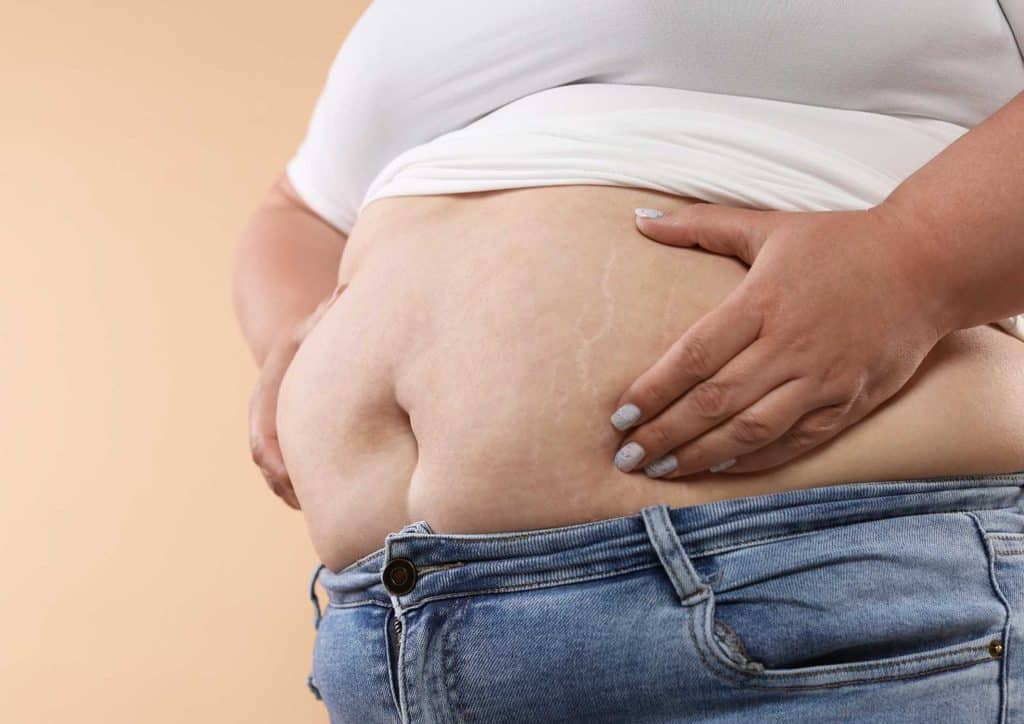 How to Lose Belly Fat: What a Nutritionist Recommends 11 A pregnant woman standing, showcasing her prominent belly with a joyful expression on her face.