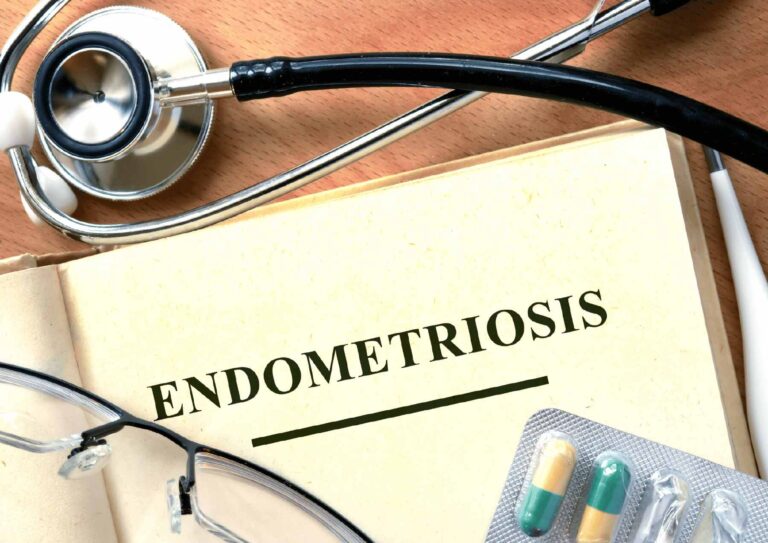 Endometriosis Nutritionist In Sydney