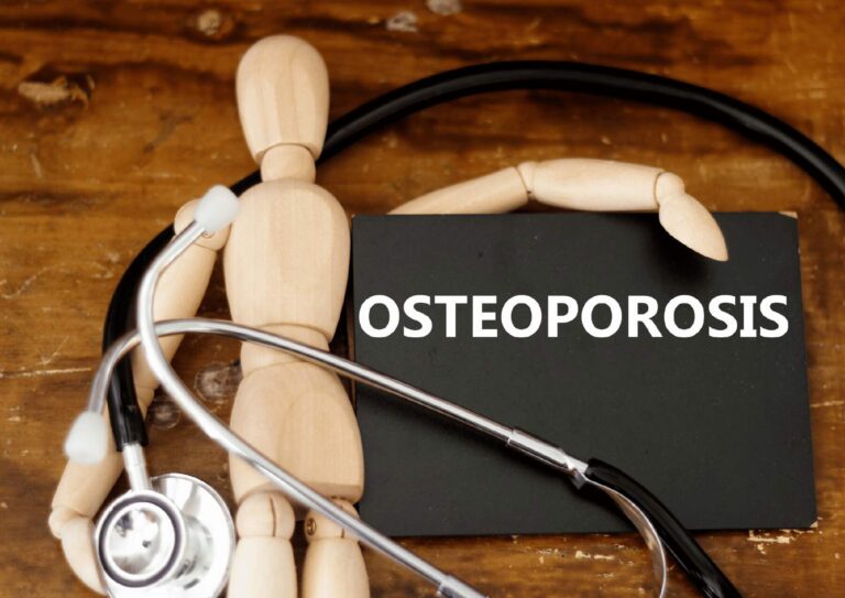 Osteoporosis Nutritionist - Nutrition Longevity With Jake Biggs - Clinical Nutritionist