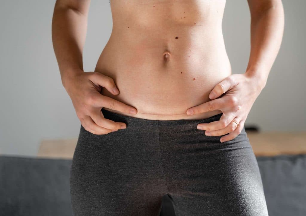 Natural Alternatives to Ozempic for Weight Loss 4 A woman confidently displays her bare stomach, showcasing her belly in a casual setting.