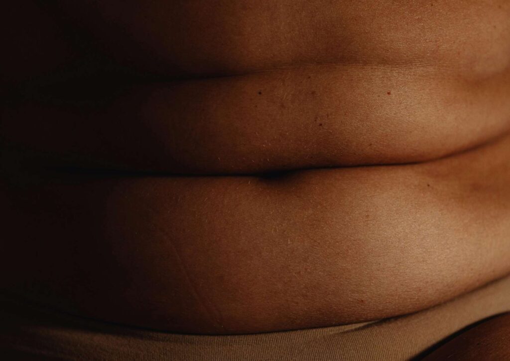 Postpartum Weight Loss: A Gentle, Realistic Guide 23 Close-up of a woman's stomach, showcasing skin texture and natural contours.